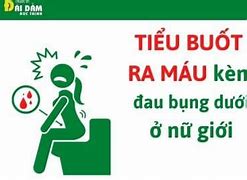 Đi Tiểu Ra Máu Nữ Giới