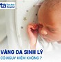 Trẻ Sơ Sinh 3 Tháng Ngủ Nhiều Có Sao Không